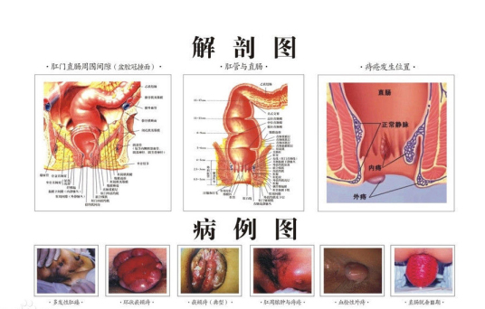 肛肠科