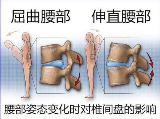 腰椎间盘