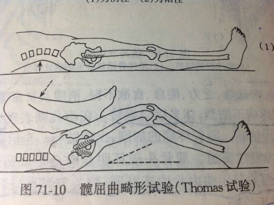 托马斯征