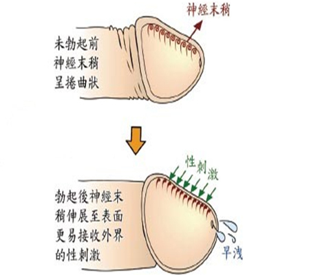 射精延迟