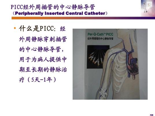 什么是经外周静脉穿刺中心静脉置管