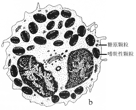 嗜酸粒细胞增多症