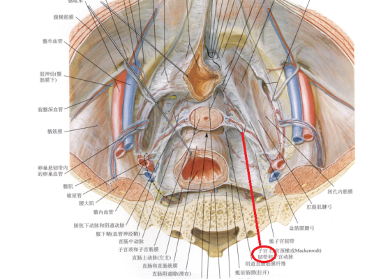 子宫主韧带