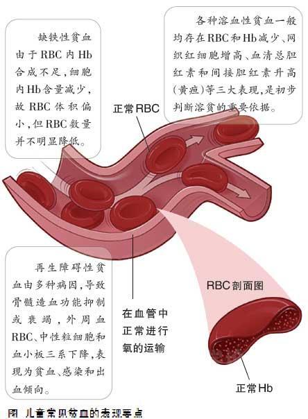 贫血症