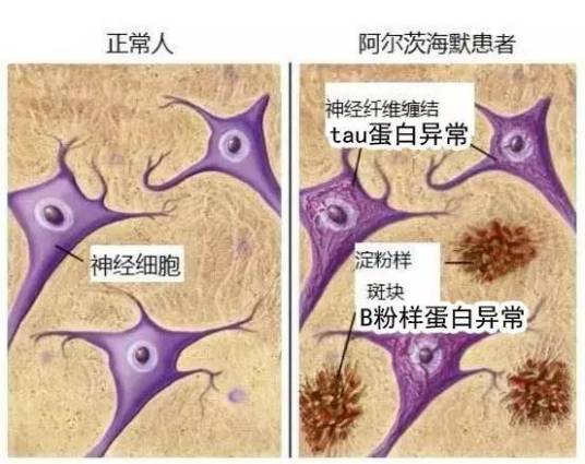 什么是tau蛋白