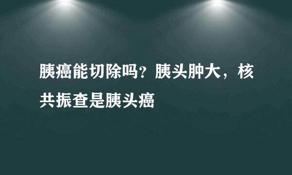 胰癌能切除吗？胰头肿大，核共振查是胰头癌