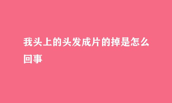 我头上的头发成片的掉是怎么回事