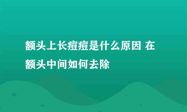 额头上长痘痘是什么原因 在额头中间如何去除