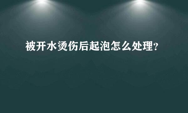 被开水烫伤后起泡怎么处理？