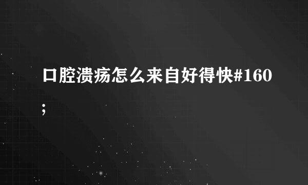 口腔溃疡怎么来自好得快#160;