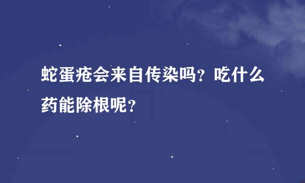 蛇蛋疮会来自传染吗？吃什么药能除根呢？