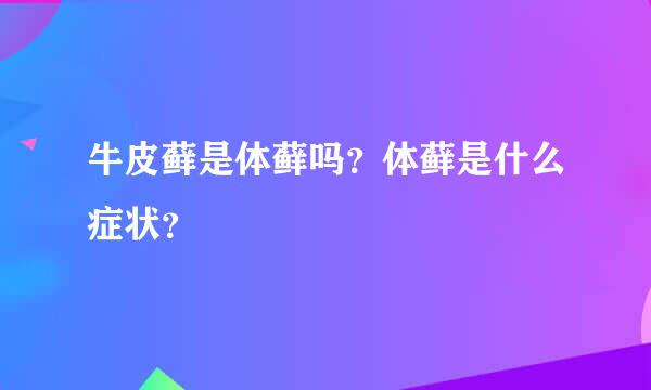 牛皮藓是体藓吗？体藓是什么症状？