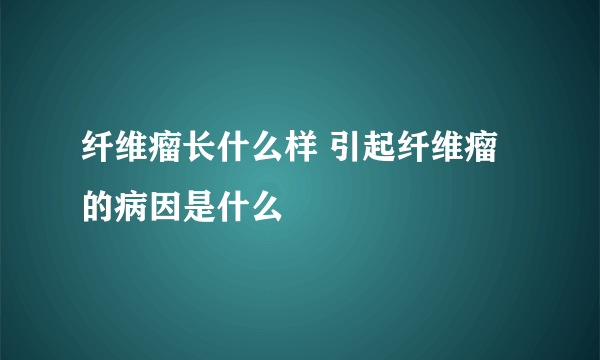 纤维瘤长什么样 引起纤维瘤的病因是什么