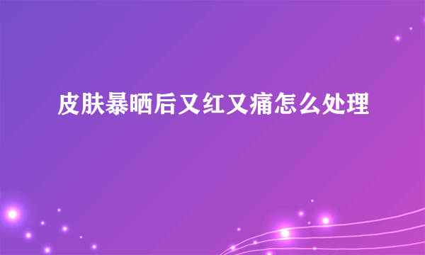 皮肤暴晒后又红又痛怎么处理