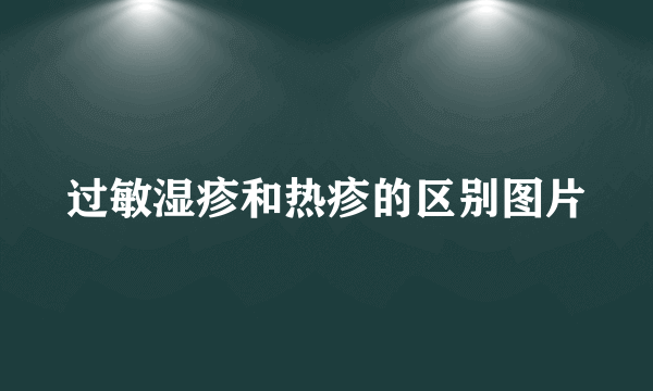 过敏湿疹和热疹的区别图片