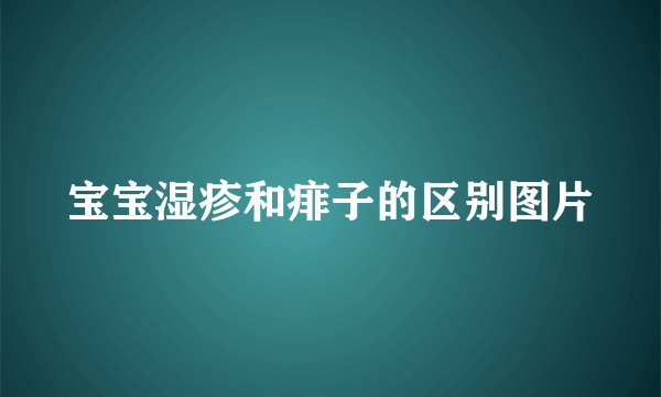 宝宝湿疹和痱子的区别图片