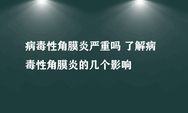 病毒性角膜炎严重吗 了解病毒性角膜炎的几个影响