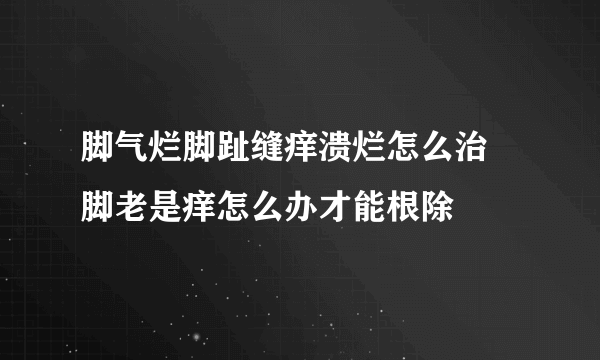 脚气烂脚趾缝痒溃烂怎么治 脚老是痒怎么办才能根除