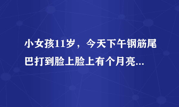 小女孩11岁，今天下午钢筋尾巴打到脸上脸上有个月亮形...