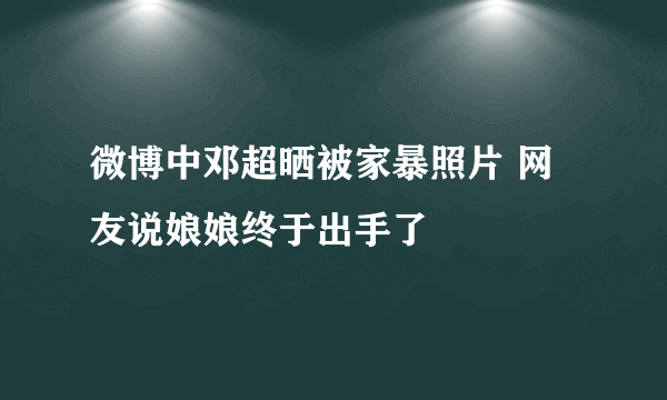 微博中邓超晒被家暴照片 网友说娘娘终于出手了