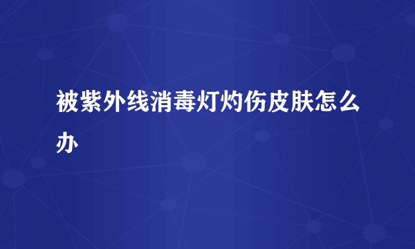 被紫外线消毒灯灼伤皮肤怎么办