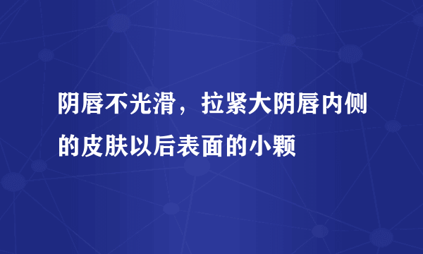 阴唇不光滑，拉紧大阴唇内侧的皮肤以后表面的小颗