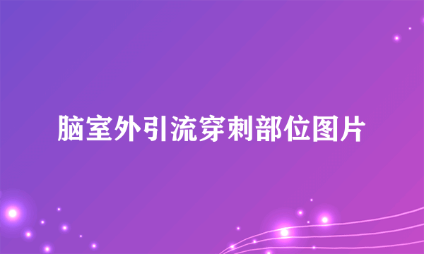 脑室外引流穿刺部位图片