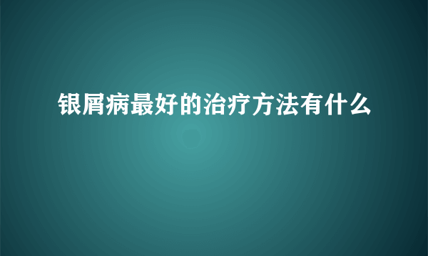 银屑病最好的治疗方法有什么