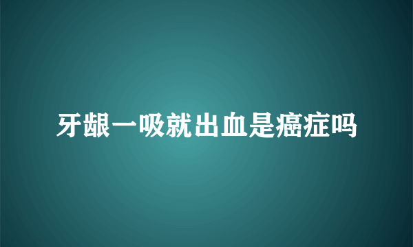 牙龈一吸就出血是癌症吗