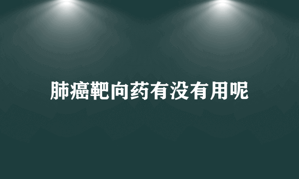 肺癌靶向药有没有用呢