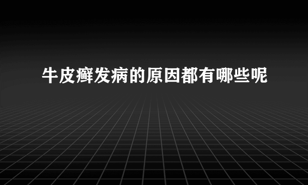 牛皮癣发病的原因都有哪些呢