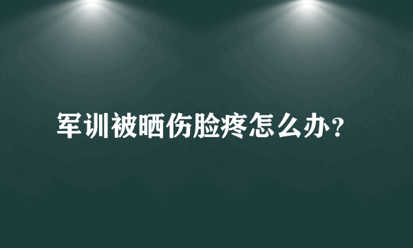 军训被晒伤脸疼怎么办？